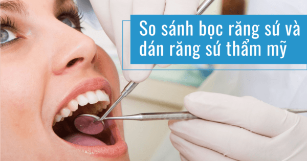 Hướng dẫn chăm sóc răng miệng khi làm răng thẩm mỹ