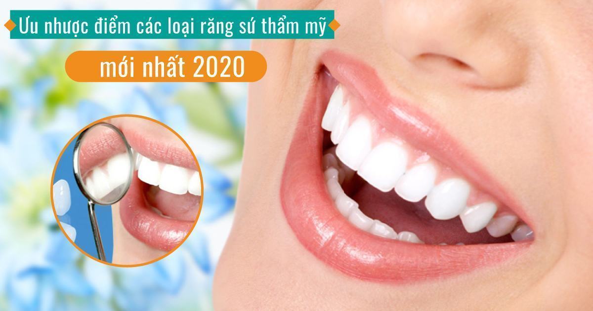 Ưu nhược điểm các loại răng sứ thẩm mỹ mới nhất 2020? Dán sứ veneer nên chọn loại nào?